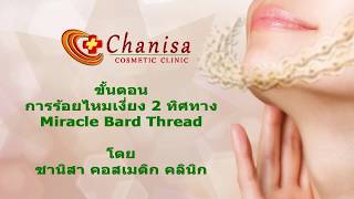 ไหมเงี่ยง 2 ทิศทาง Chanisa cosmetic clinic ไหมเงี่ยง 2 ทิศทาง Chanisa cosmetic clinic