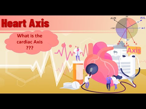 How to determine heart axis | heart axis interpretation | principles, ECG findings and 4 examples