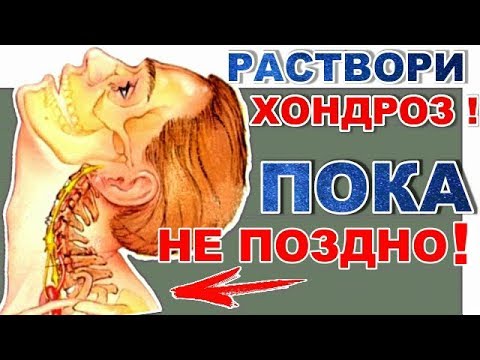 Цена замены коленного сустава в челябинске цены Головокружение тошнота слабость лечение при остеохондрозе