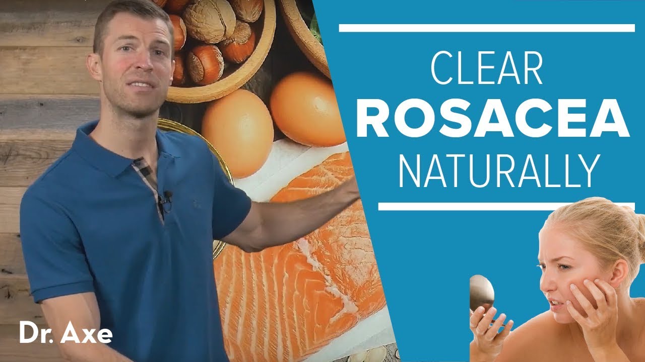 Rosacea Treatment: Help Clear Redness Naturally in 7 Steps