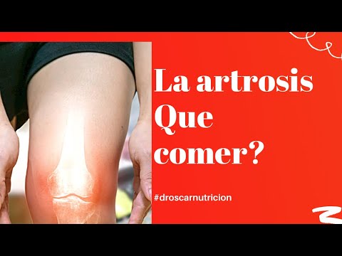 La artrosis, Que comer?