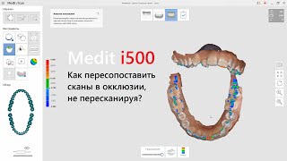 Medit i500 - Как пересопоставить сканы в окклюзии, не пересканируя?