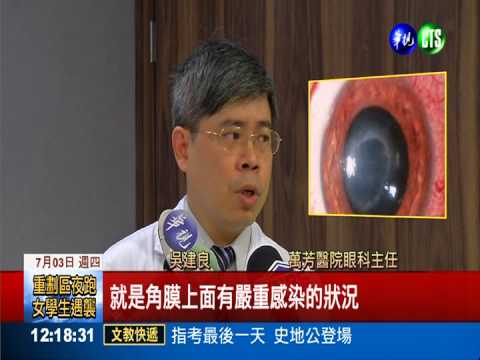 隱形眼鏡半年沒摘 角膜被噬一半
