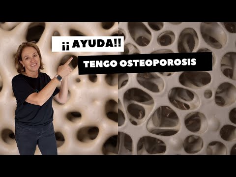 ¡¡ AYUDA !! TENGO OSTEOPOROSIS