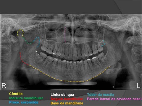 Anatomia em radiografia panorâmica