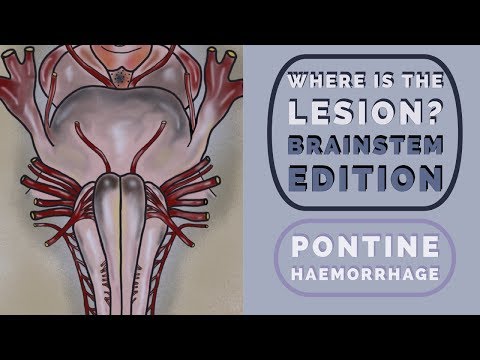 Brainstem Reflexes: Where is the lesion?