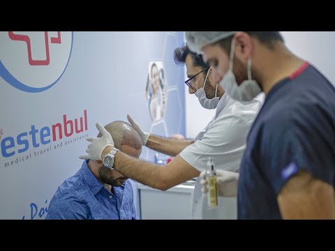 Sapphire FUE Hair Transplant Process - Hair Transplant in Turkey