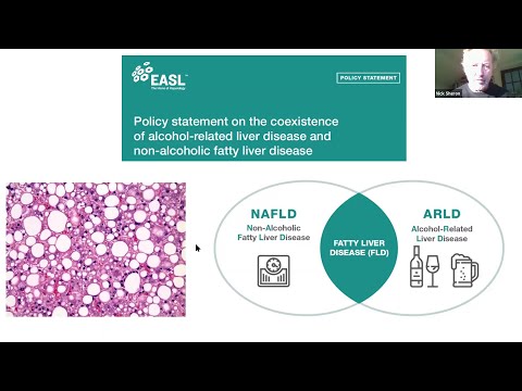 EASL Policy Statement on the coexistence of NAFLD and ARLD (Patient Forum 2020)