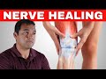 How Long Do Nerve Endings Take To Heal After Knee Replacement Surgery?