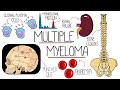 Understanding Multiple Myeloma (Multiple Myeloma Explained Clearly)