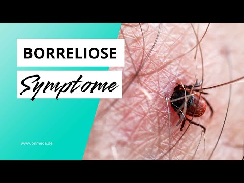 Das sind Warnzeichen einer Borreliose