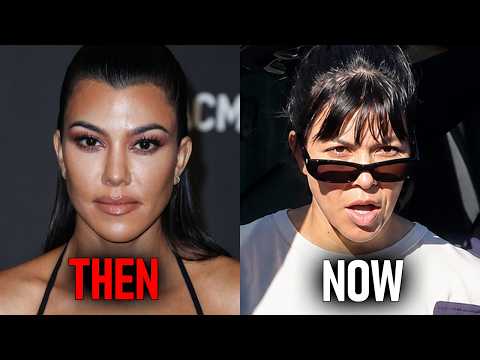 Before After Jen Psakis Shocking Plastic Surgery Journey