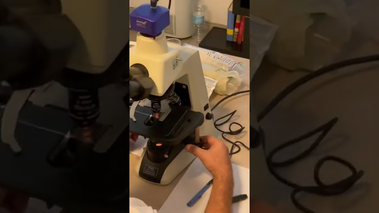 Analisi del sangue a campo oscuro