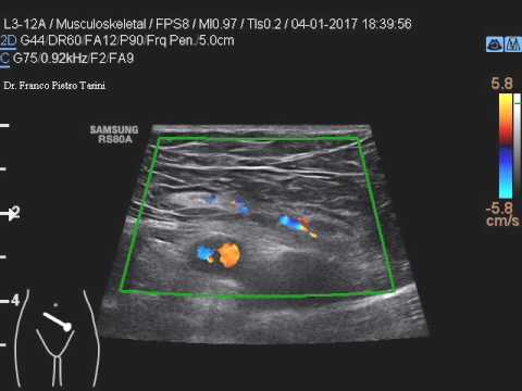 Malattie della foto ginocchio Come rimuovere il mal di schiena acuto