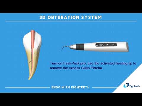 How to Use Eighteeth Obturation System Fast-Pack Fast-Fill Continuous Wave Compaction WVC