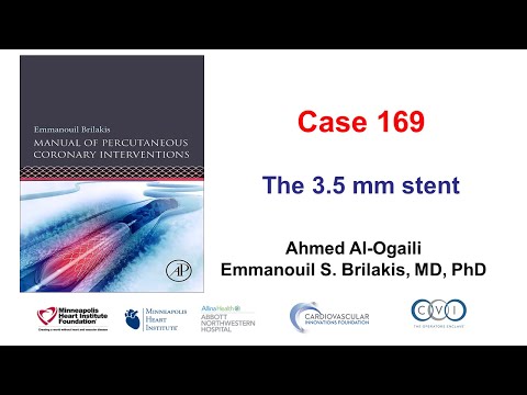 Case 169: Manual of PCI - The 3.5 mm stent