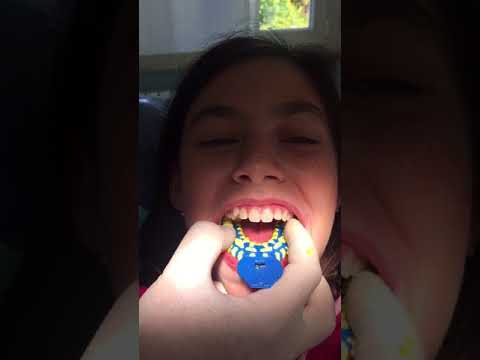 download lagu mp3 mp4 Blog Dentista, download lagu Blog Dentista gratis, unduh video klip Blog Dentista