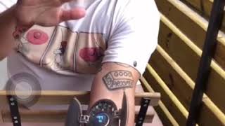 Nessly’s Antares Auto-Tune Arm Implant