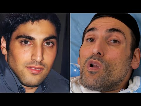 "ביום אחד אתה הופך למשותק, כמו פסל": אלון פז בסיפורו האישי והבלתי יאומן