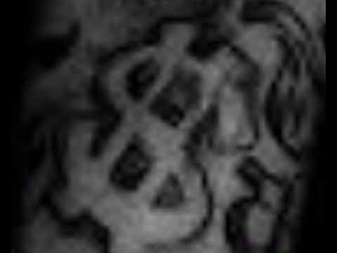 #FREETRAVHONEY TravHoney Wit Da Money - Lil Top By @NbaYoungBoy  ( I Don’t Really Talk )