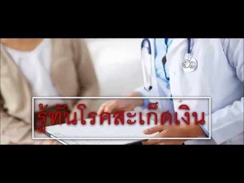 ครีม methyluracyl สำหรับโรคสะเก็ดเงิน กลากกระต่ายปุย