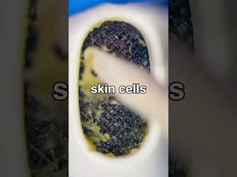 Clean Your Earbuds!!! They are probably gross!