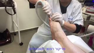 פדיקור רפואי לסוכרתיים