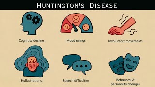 Huntington's disease | An overview
