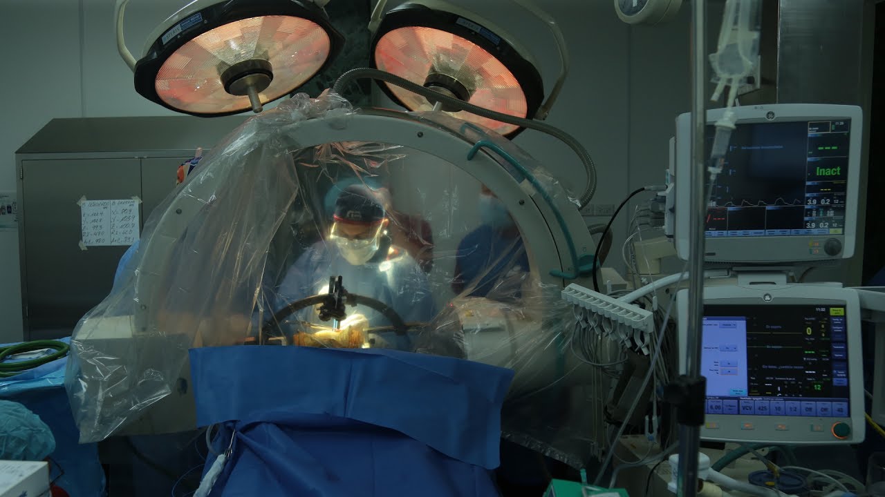 Juan Carlos Benedetti Isaac-19