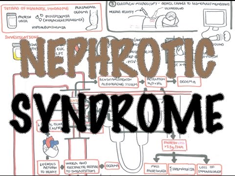 Le Syndrome Néphrotique - Vue d'Ensemble