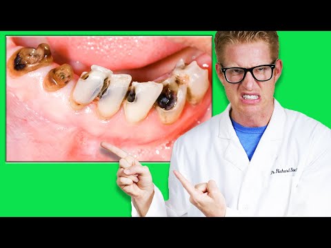 Dentist Reveals WHAT CAUSES CAVITIES & How to PREVENT TOOTH DECAY!