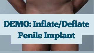 Download lagu How to Use Your Penile Implant: Coloplast Titan Touch Demo (Subcoronal Approach) mp3