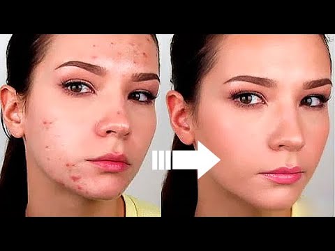 Отбеливание для лица в аптеке Маска для лица убрать пигментные пятна на