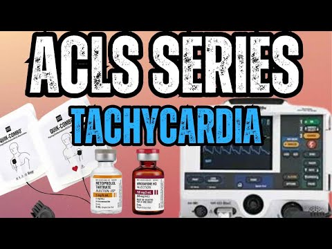 Tachycardia with a Pulse Algorithm