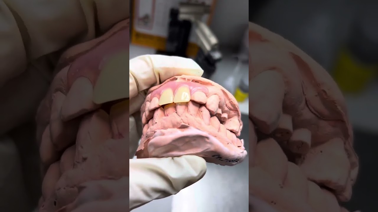 Dental Lab China, Dental Laboratory China, China Outsourcing Dental Lab, Dental Lab Chinese