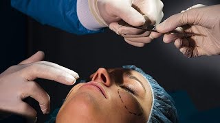 Will Lower Eyelid Op Get Rid of Bags? | Plastic Surgery
