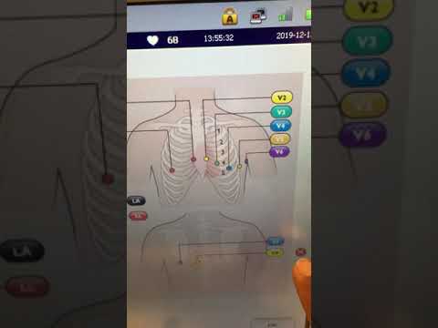 Philips Pagewriter TC70 ECG Machine - Refurb