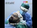 SAY NO TO BALDNESS! | ALKHALEEJ ICE FUE HAIR TRANSPLANT