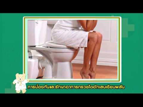 สูตรประชาชนเพื่อความอ่อนแอ สมาชิกพลาสติกอีร์คุตส