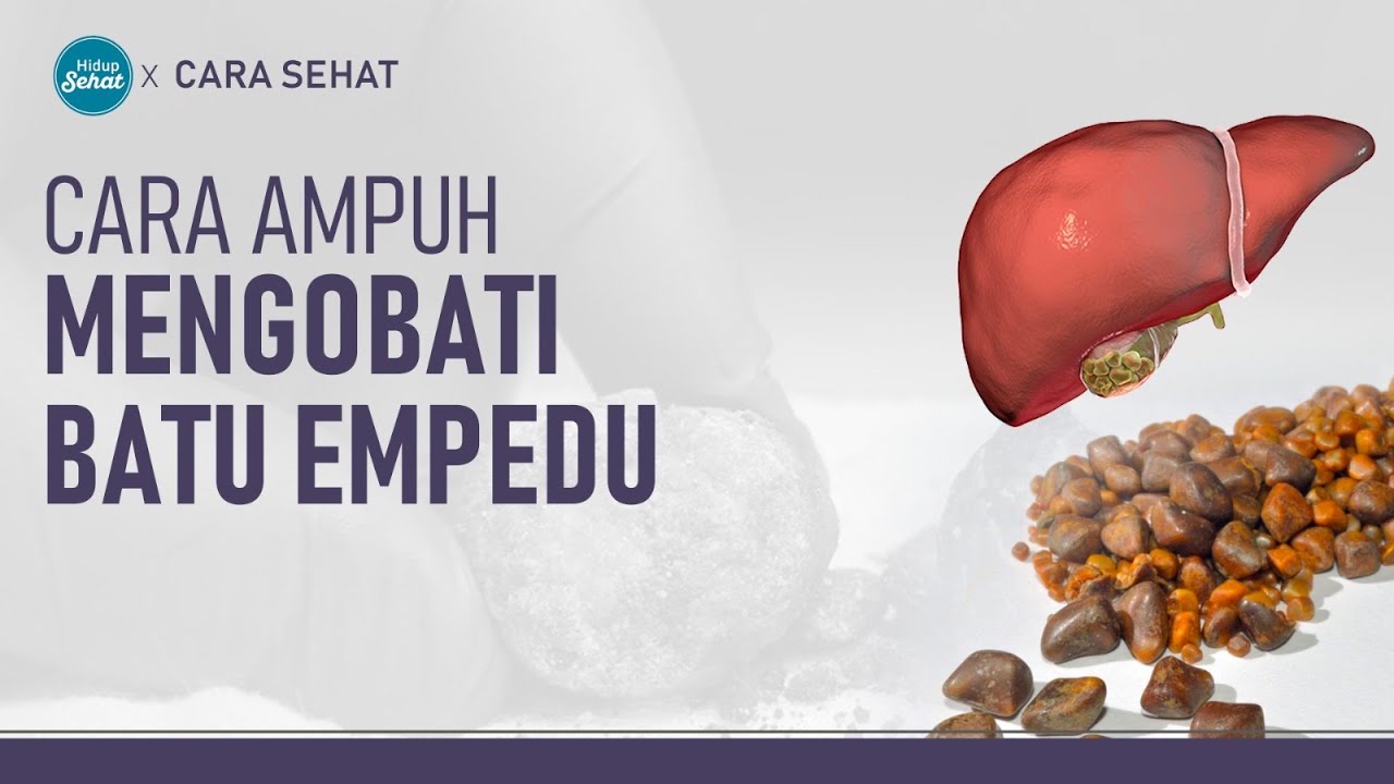 Penyakit Batu Empedu dan Cara Pengobatannya Penyakit Batu Empedu dan Cara Pengobatannya