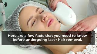 Facts You Need To Know Before Getting Laser Hair Removal