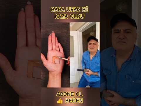 baba ufak bi kaza oldu 😲 #comedy