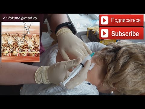 Лошадь запястный сустав Болит ли спина при грыже шморля