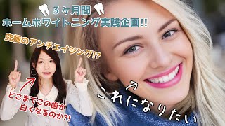 【実録】３ヶ月間ホームホワイトニングやってみた【レポート】