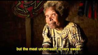 Kuru - A medical detective story - Trailer