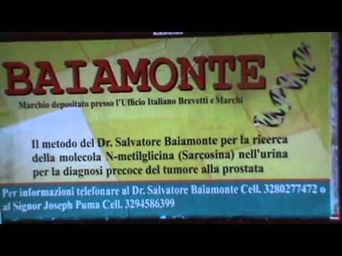Orgasmo attraverso la stimolazione della prostata Massaggiatore prostata elettronico