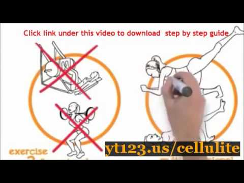 Revitol for cellulite solution review