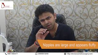 Puffy Nipples Treatment by Dr. Amit Gupta (Divine Cosmetic Surgery)