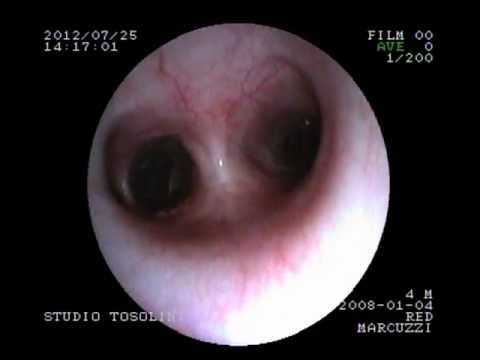 comment soigner streptococcus agalactiae