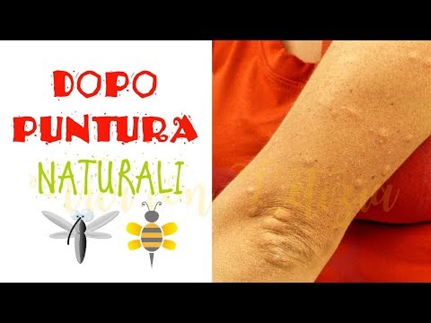 Articolazioni artritiche di mani e piedi Giunti dopo lallungamento